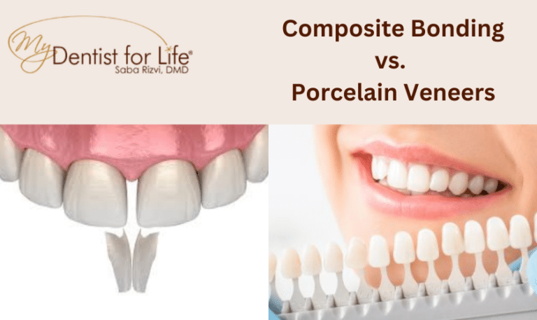 Composite Bonding Vs Porcelain Veneers Which Is Best