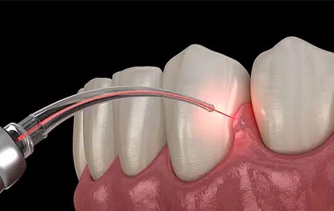 Female dentist in Plantation FL