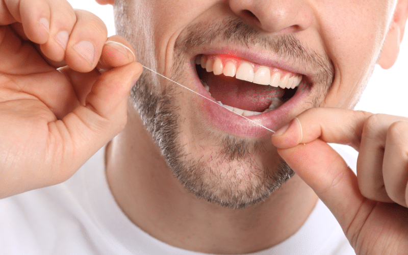 Bleeding Gums While Flossing