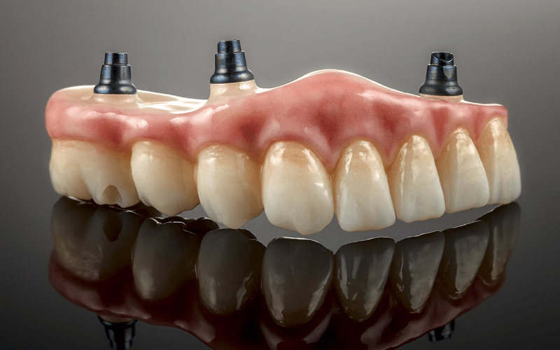 full or partial dentures