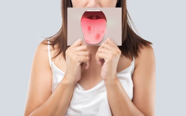 is your tongue trying to tell you something about your health